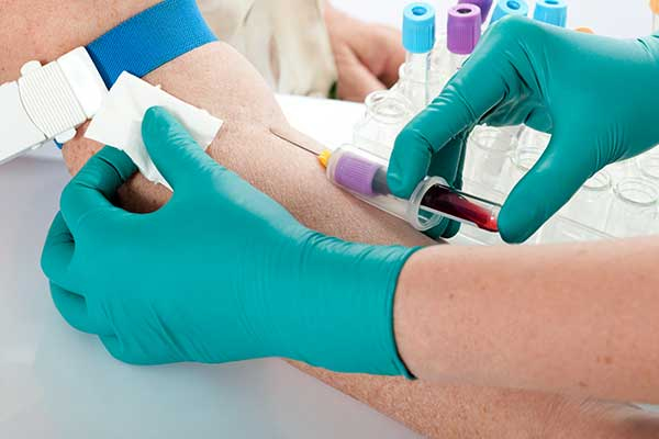 Check Tru Early Warning Signs of Diseases That Diagnostic Tests Can Detect ...