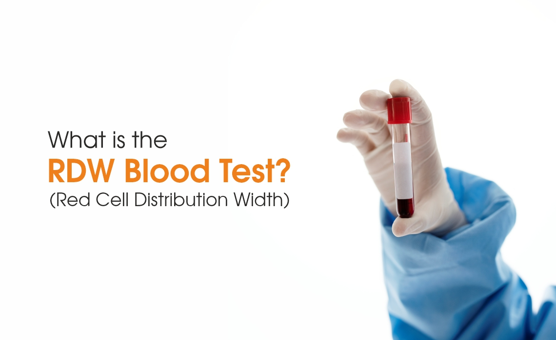 Understanding RDW in Blood Test: A Comprehensive Guide | Manipal TRUtest